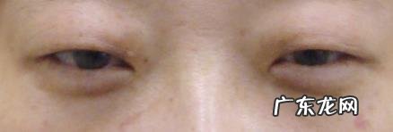 单眼皮好看的特征是什么?