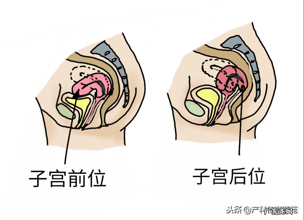 子宫内膜炎可以自愈吗 子宫内膜