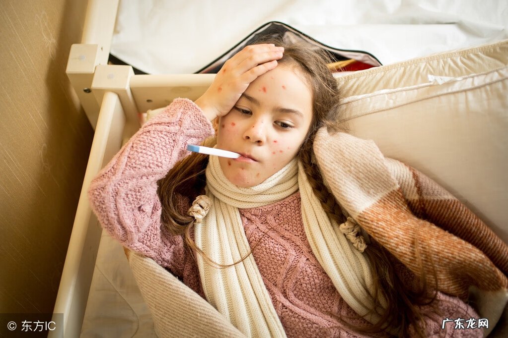 人体100种皮肤病对照图 麻疹