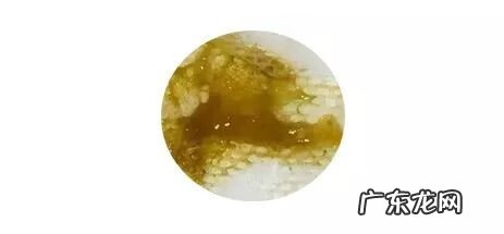 婴儿大便有粘液正常吗 宝宝大便有粘液怎么办