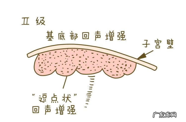 胎盘厚度是什么意思 胎盘厚度代表什么