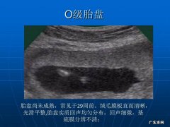 胎盘厚度是什么意思 胎盘厚度代表什么