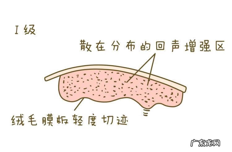 胎盘厚度是什么意思 胎盘厚度代表什么