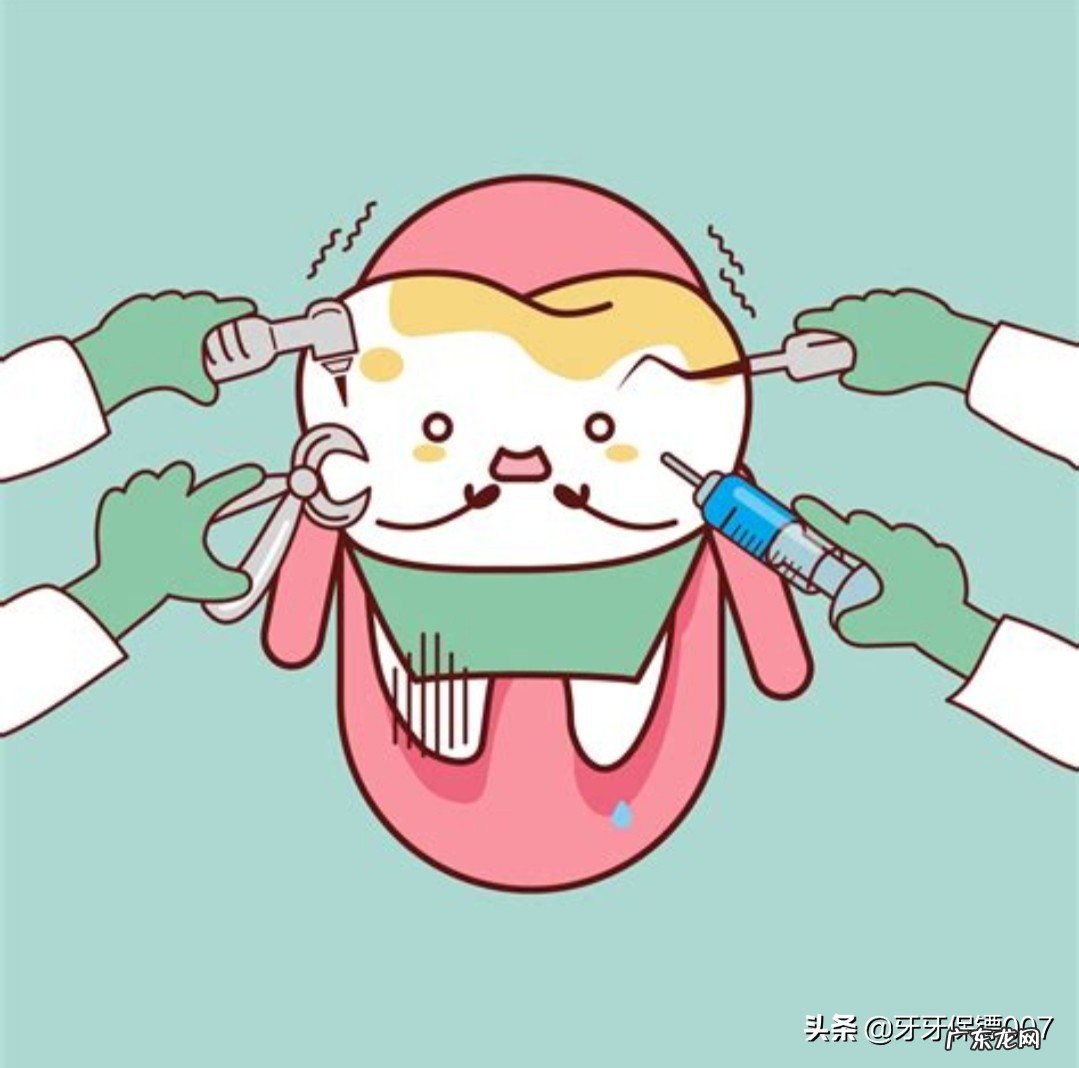 嘴巴里最里面的一颗牙齿被虫子吃了一半,也不痛,要不要去补?