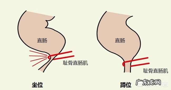 便秘的人怎么调理 便秘的真正原因是什么