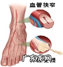 整条腿发麻是什么原因 一条腿发麻是怎么回事