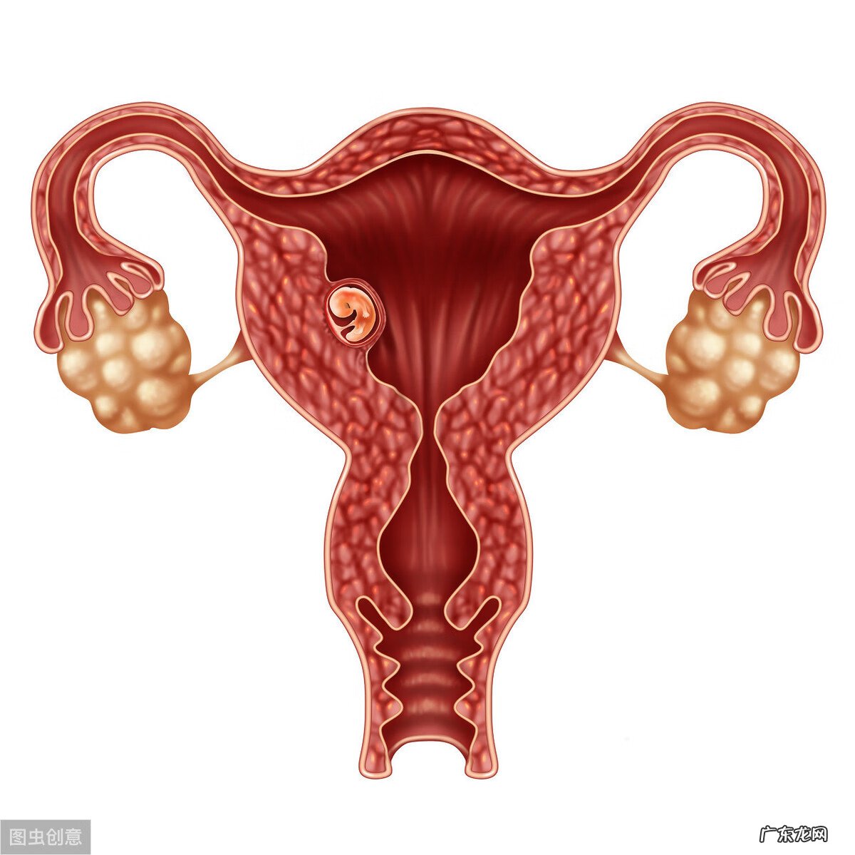 有子宫肌瘤要不要把环取出来 什么叫子宫内膜移位