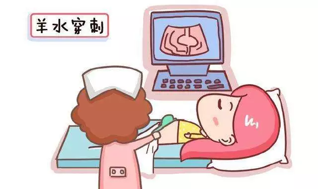 羊水穿刺需要几分钟 羊水穿刺时间什么时候合适