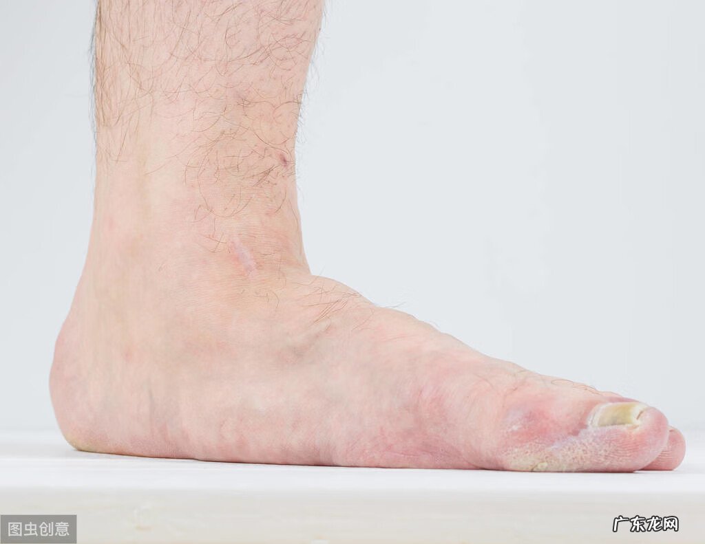 平足是正常的吗 平足