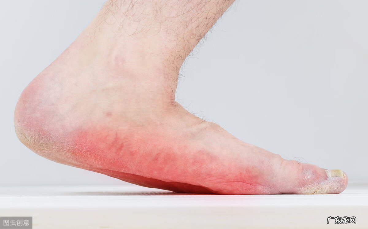 平足是正常的吗 平足