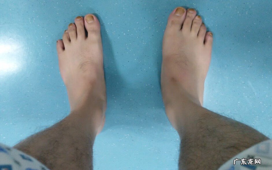 平足是正常的吗 平足