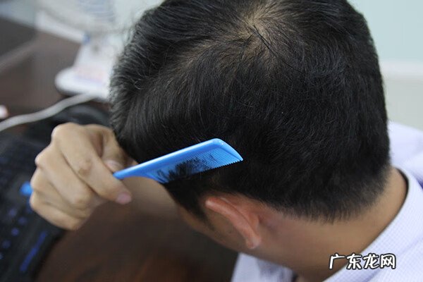 为啥少白头有福 额头中长白发不养娘