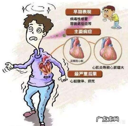 急性心肌炎会导致猝死吗?