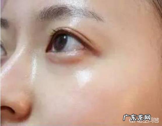 光子嫩肤好,还是水光针好?两者能同时做吗?