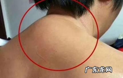 六个动作消除富贵包 富贵包