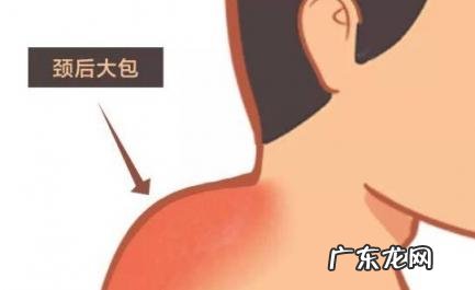 六个动作消除富贵包 富贵包