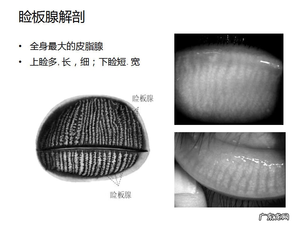 眼睑炎症的症状 眼睑炎怎么引起的