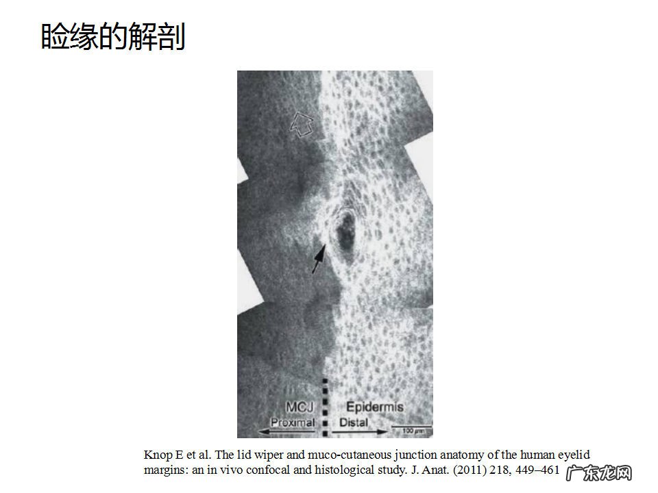 眼睑炎症的症状 眼睑炎怎么引起的