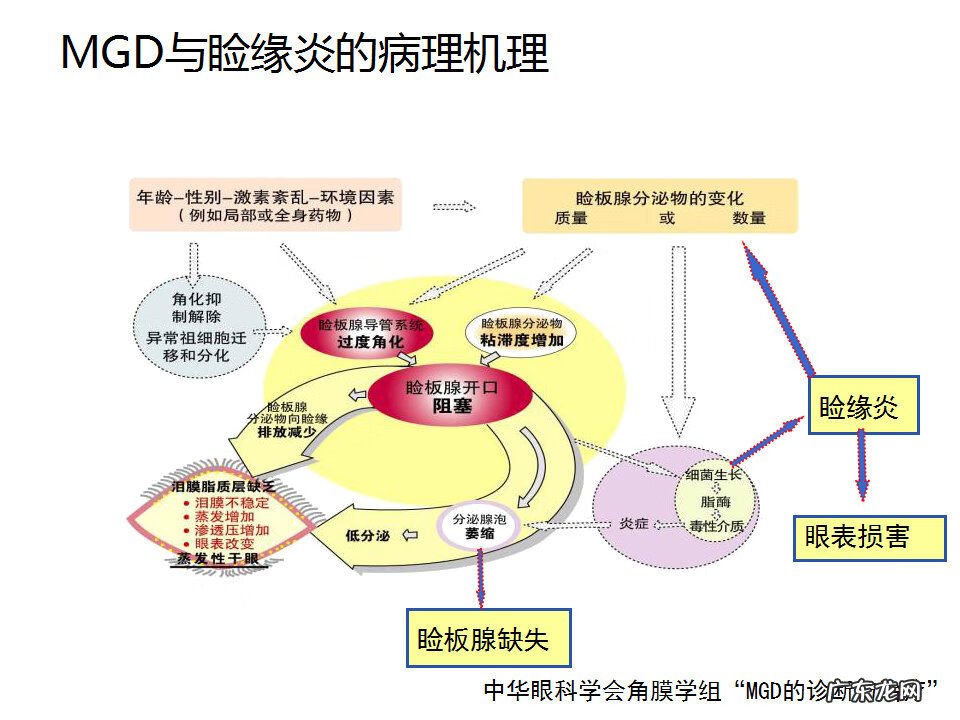 眼睑炎症的症状 眼睑炎怎么引起的