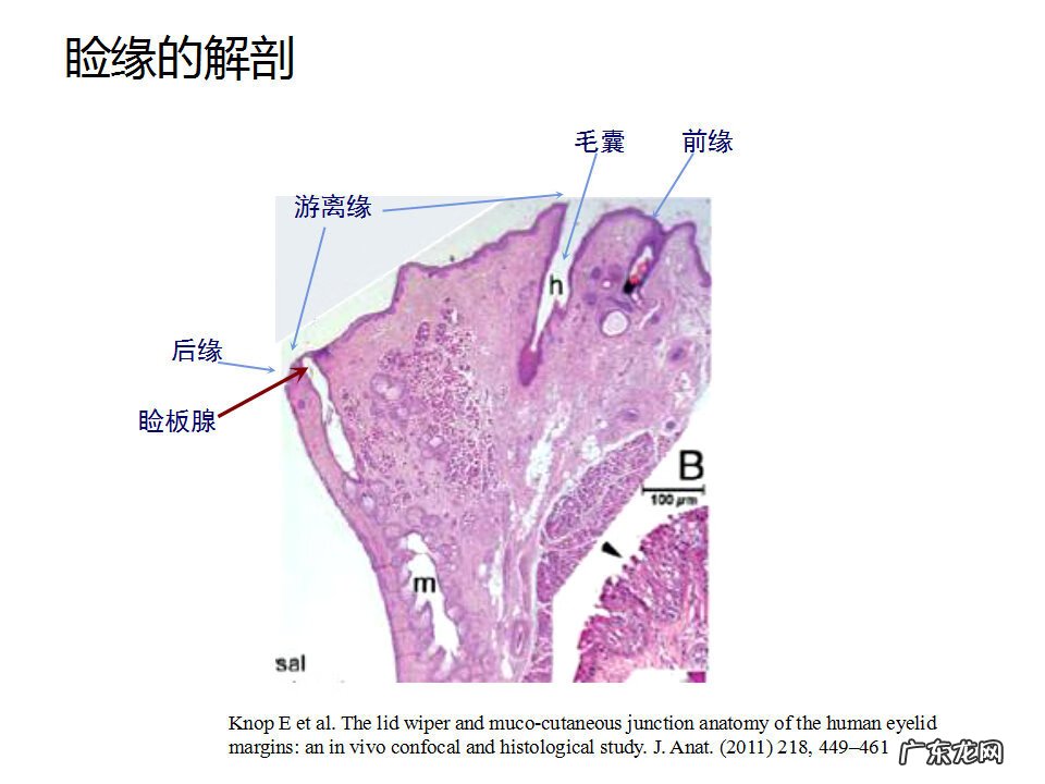 眼睑炎症的症状 眼睑炎怎么引起的