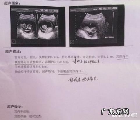 怀孕两个月吐了两周，突然就好了正常吗，要注意什么？