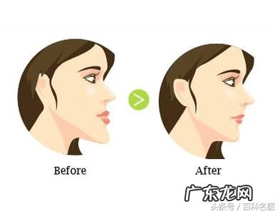 牙齿畸形的四种类型 牙齿畸形有哪几种