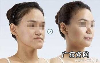 牙齿畸形的四种类型 牙齿畸形有哪几种