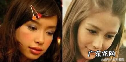 牙齿畸形的四种类型 牙齿畸形有哪几种