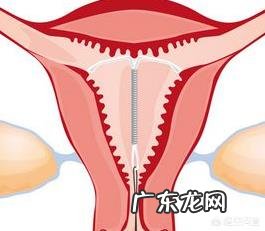 上节育环到底好不好?对身体有什么伤害?