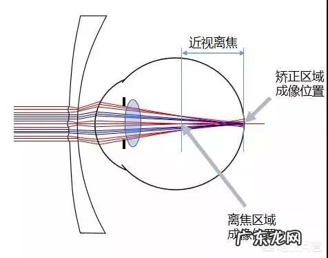 国家重视防控近视了，那家长应该怎么办？