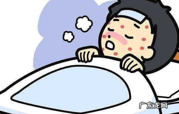 荨麻疹会传染给家人吗 荨麻疹传染吗