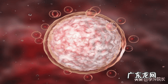 泌乳素高会不孕吗 泌乳素高不孕怎么治疗