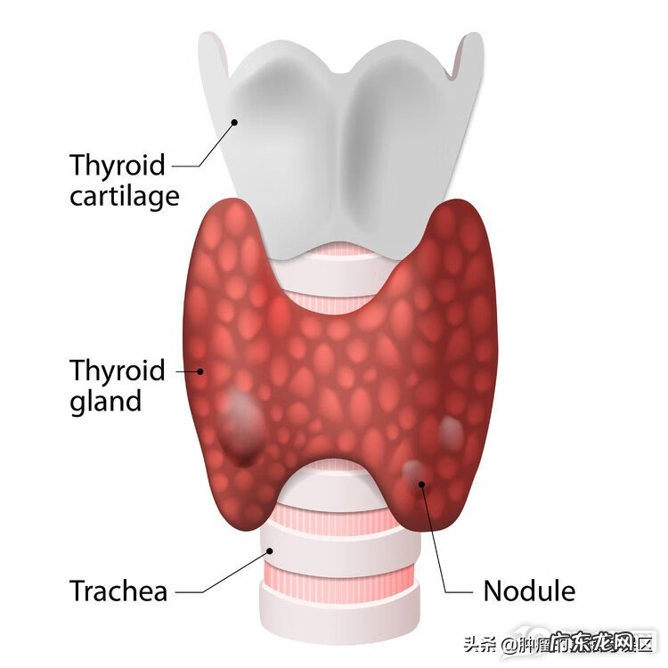 结节什么形状的不好 结节问题大吗