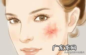 人的脸上为什么会长红血丝 脸上长红血丝怎么回事?