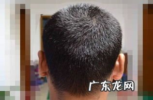 发际线一般在哪个位置 发际线是什么意思图片女生