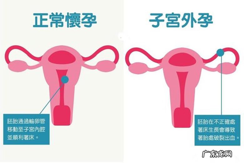 孕妇孕检项目 孕检项目有哪些