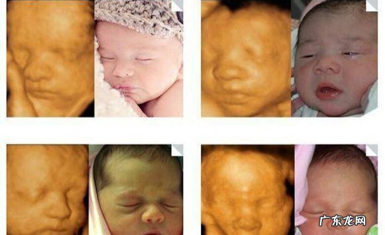 孕妇孕检项目 孕检项目有哪些