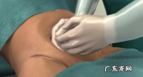 剖腹产的真实过程 剖腹产过程及步骤组图