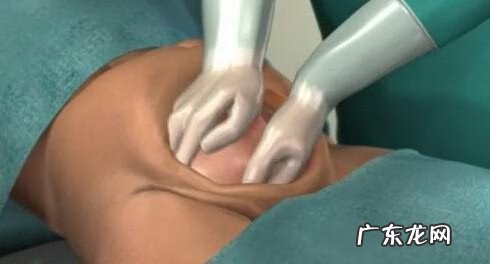 剖腹产的真实过程 剖腹产过程及步骤组图