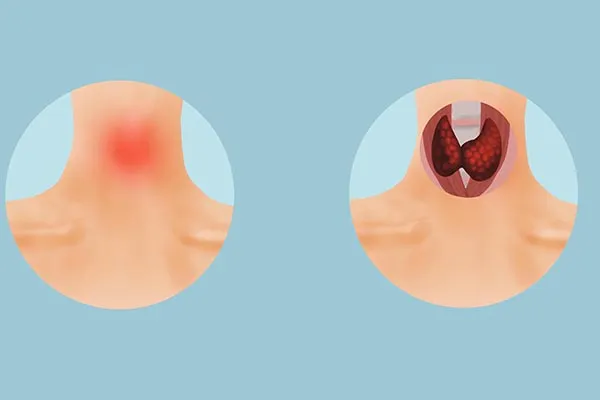 含碘的食物有哪些高的食物有哪些