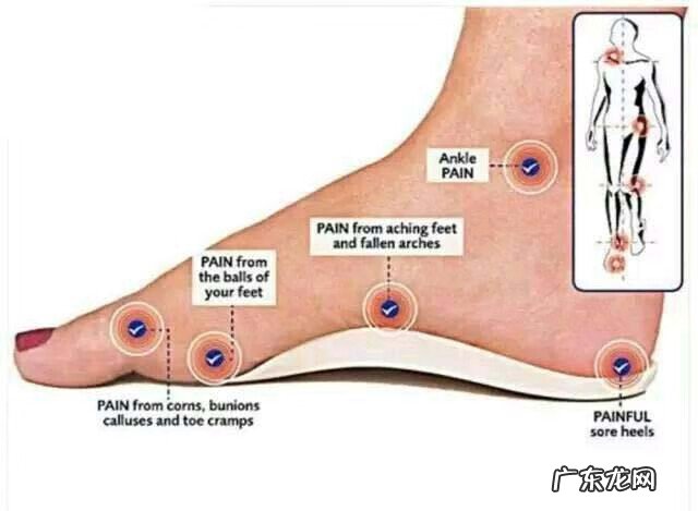 扁平足是什么病 平足症是什么