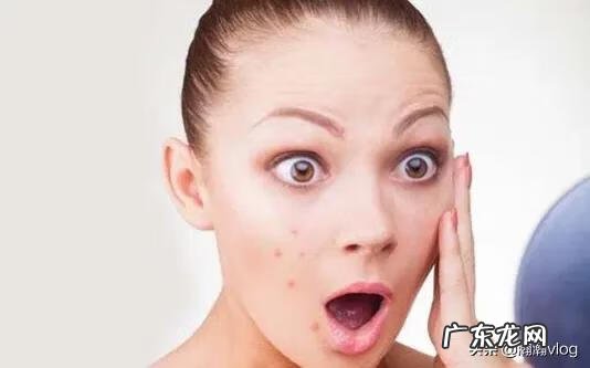 鼻子上长痘痘是因为什么 鼻子有痘痘怎么办