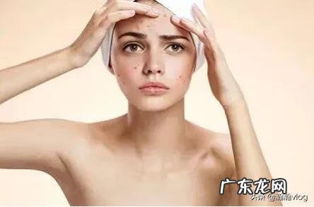 鼻子上长痘痘是因为什么 鼻子有痘痘怎么办
