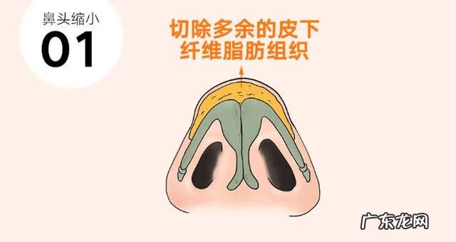 怎样让鼻头自然变小 怎样让鼻头变小?