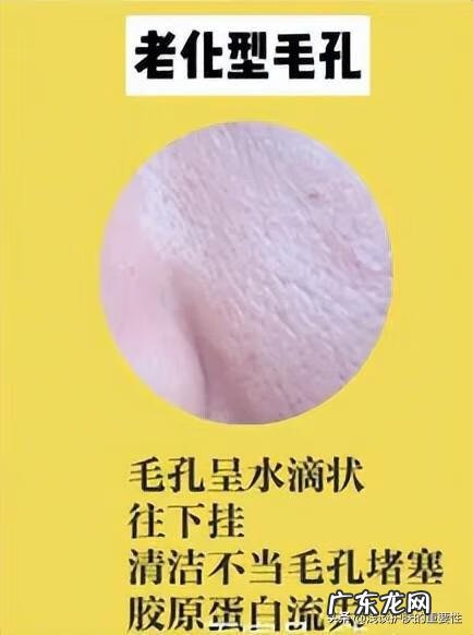 脸部毛孔变大怎么办 脸颊的毛孔大怎么办