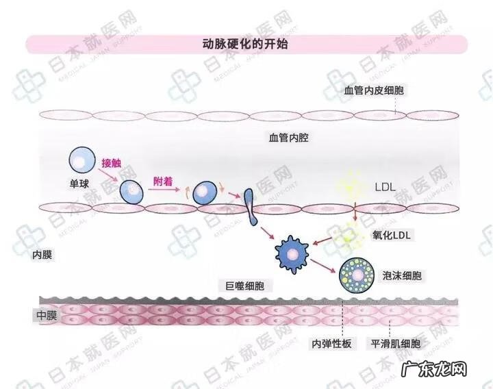 炎症是怎么引起的 炎症怎么办才能彻底消除