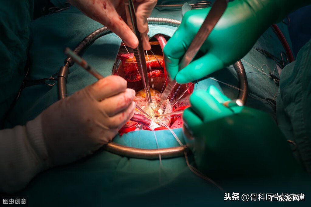 儿童风湿病 儿童风湿热最主要的危害是