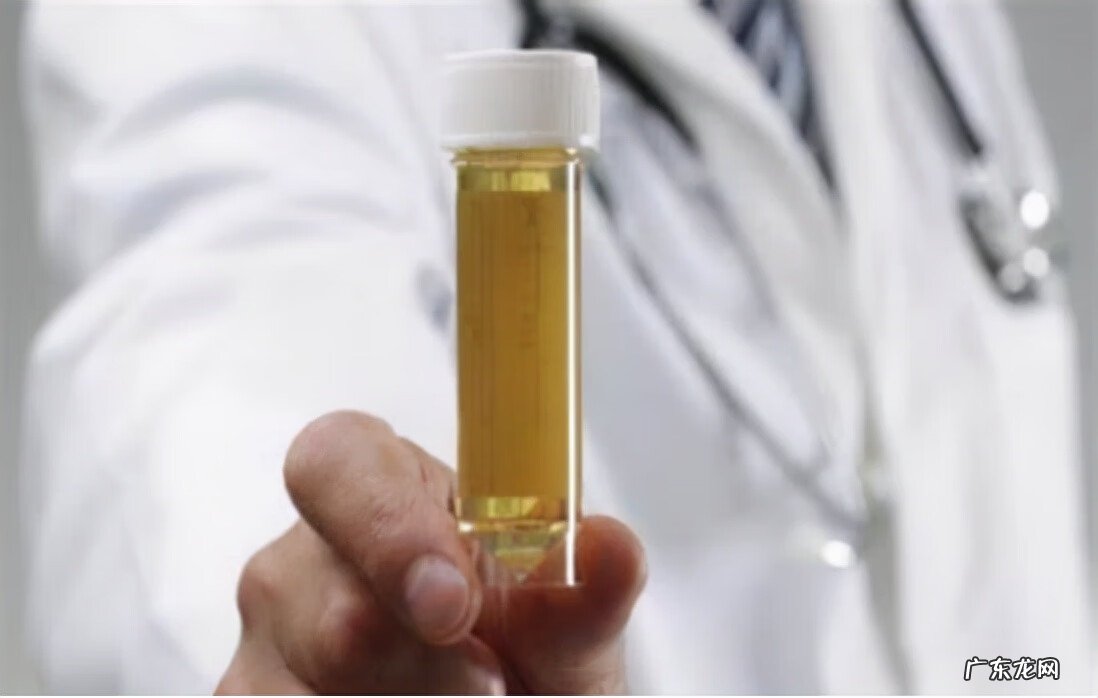 补充维生素b2的食物 维生素B2的食物有哪些