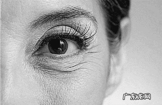 去鱼尾纹 鱼尾纹怎么去除