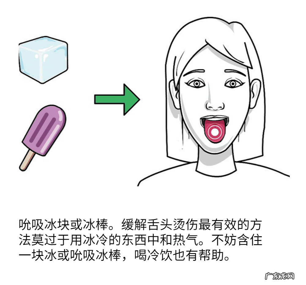 嘴巴舌头烫伤了怎么办 舌头烫伤该怎么办